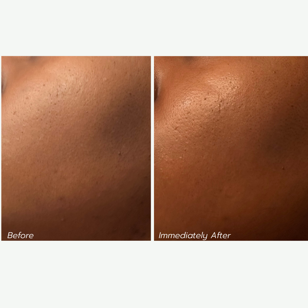 Nourishing Moisturizer