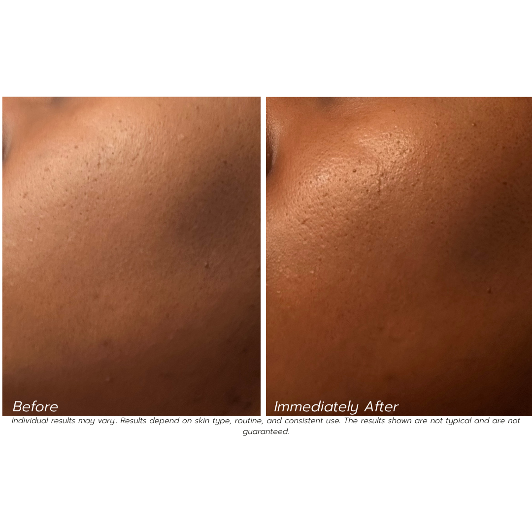 Before and after comparison of skin texture on a white background